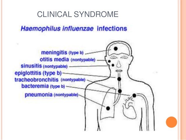 haemophilus influenzae pneumonia haemophilus influenzae type b vaccine